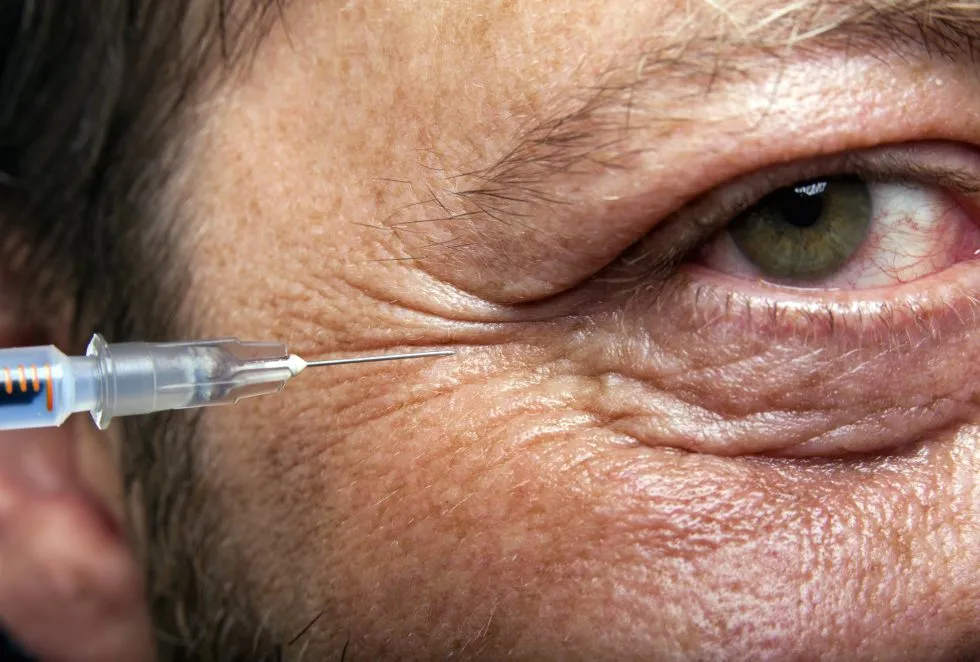 Un gros plan du visage d'une personne montre une aiguille de seringue près de la peau, juste sous l'œil, suggérant une injection cosmétique ou médicale. L'œil de la personne est ouvert et des détails de la texture de la peau sont visibles.